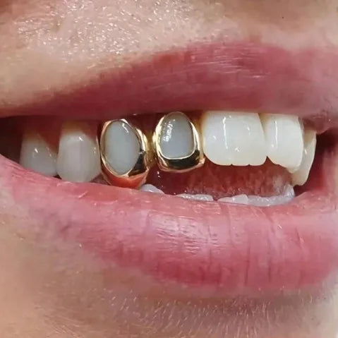 Grillz 2 dents — Groumia